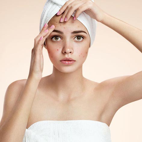 Best Natural Oils For Acne Scar Treatment That Will Soothe The Skin Best Natural Oils For Acne Scar Treatment That Will Soothe The Skin